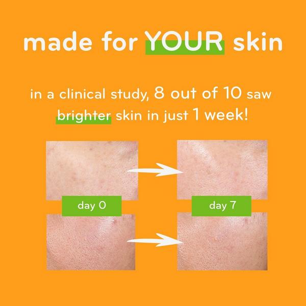 Ulta AmLactin  Daily Vitamin C Lotion With 7% Lactic Acid AHA