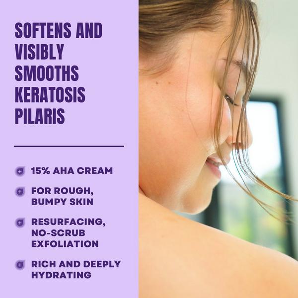 Ulta AmLactin  KP Bumps Be Gone Cream With 15% Lactic Acid AHA