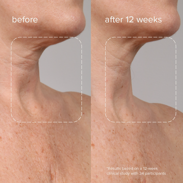 Ulta Bdy.  Renewing Overnight Body Serum With Bakuchiol + Hyaluronic Acid