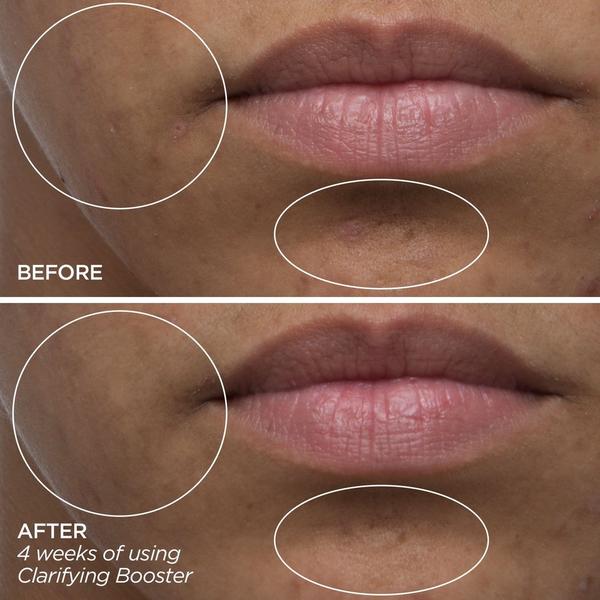 Ulta BeautyBio  Clarifying Booster - Salicylic Acid Treatment Serum
