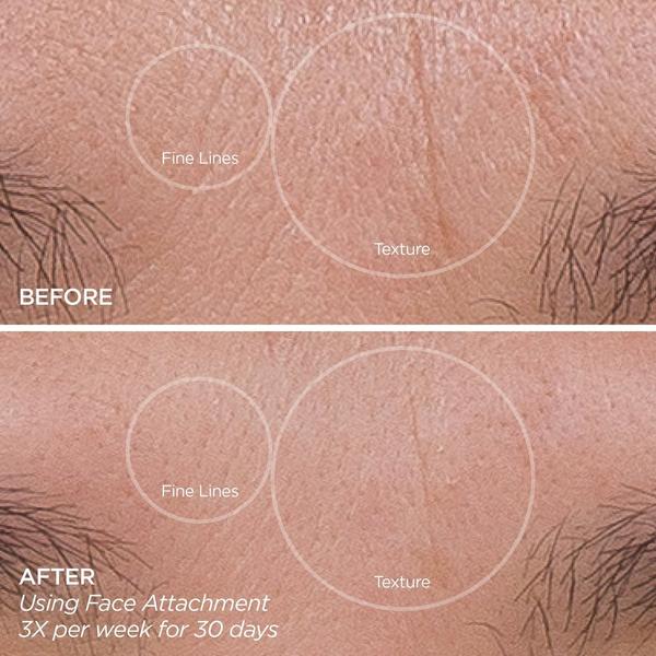 Ulta BeautyBio  Eye Want It All Face + Eye Rejuvenation Set