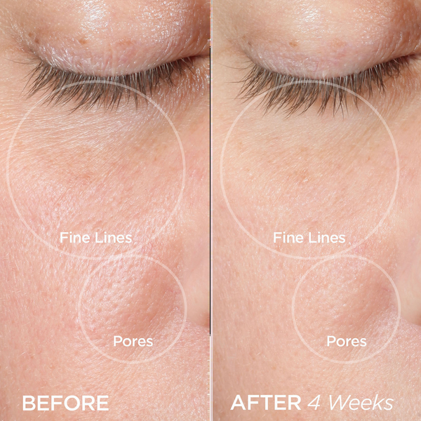 Ulta BeautyBio  The ZenBubble Oil-Free Calming Gel Cream