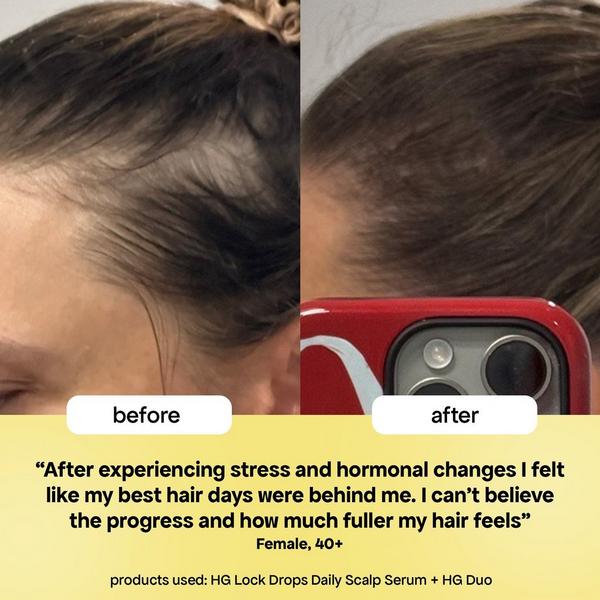 Ulta Bondi Boost  HG Lock Drops Scalp Serum For Thinning Hair