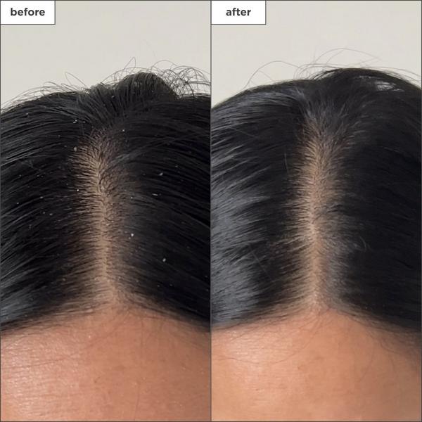 Ulta Briogeo  Scalp Revival Charcoal + Tea Tree Buildup Detox Spray