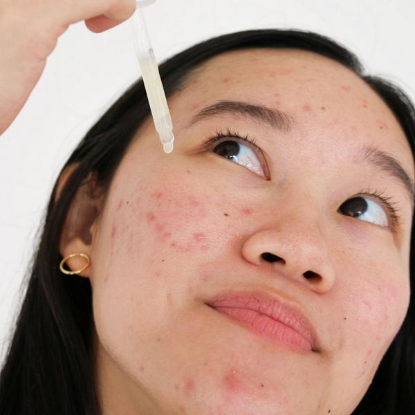 Ulta Cocokind  Postbiotic Acne Serum For Clear And Balanced Skin