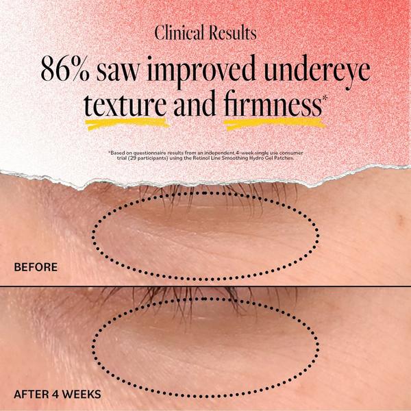 Ulta DERMA E  Retinol Line Smoothing Hydro Gel Patches