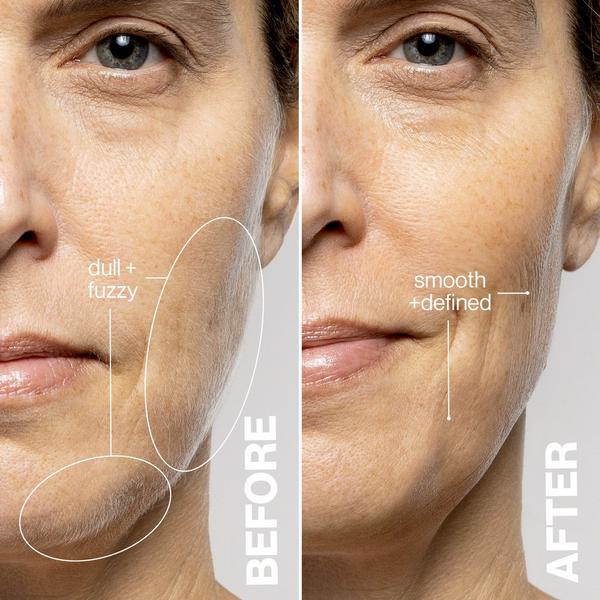 Ulta DERMAFLASH  LUXE+ Advanced Sonic Dermaplaning + Peach Fuzz Removal