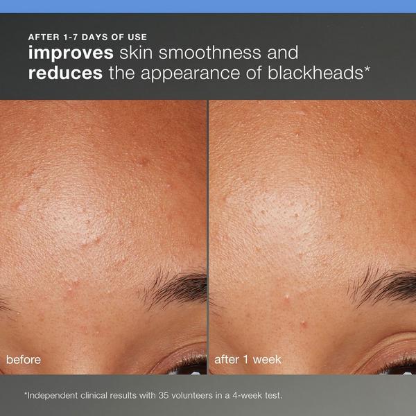 Ulta Dermalogica  Discover Healthy Skin Complete Regimen Kit