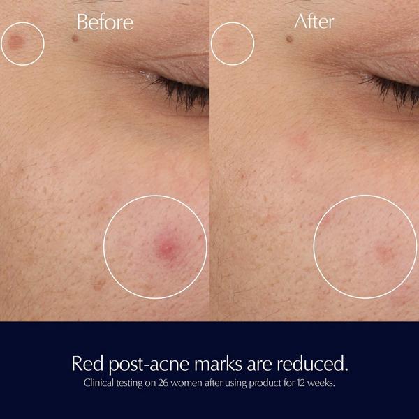 Ulta Estée Lauder  Advanced Night Repair Rescue Solution Serum With 15% Bifidus Ferment