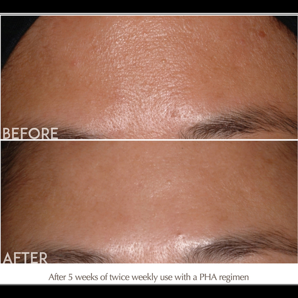 Ulta Exuviance  Performance Peel AP25 At-Home Facial Peel