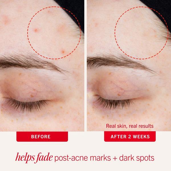 Ulta First Aid Beauty  Daily Resurfacing Moisturizer With 2% Niacinamide