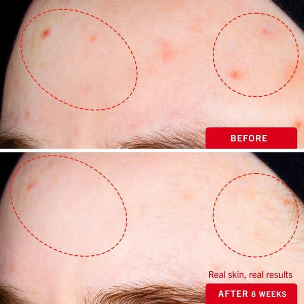 Ulta First Aid Beauty  Daily Resurfacing Moisturizer With 2% Niacinamide