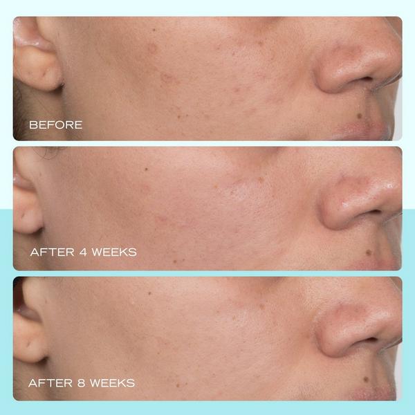 Ulta First Aid Beauty  Facial Radiance Niacinamide Dark Spot Serum