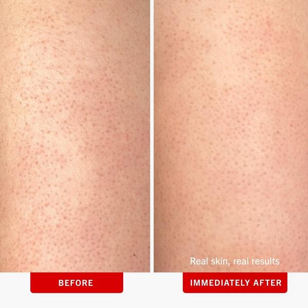 Ulta First Aid Beauty  KP Bump Eraser Body Scrub Fresh Strawberry