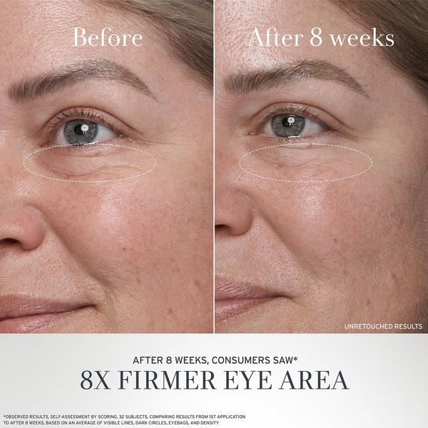 Ulta Fresh  Black Tea Anti-Aging Eye Cream With Retinol-Alternative BT Matrix