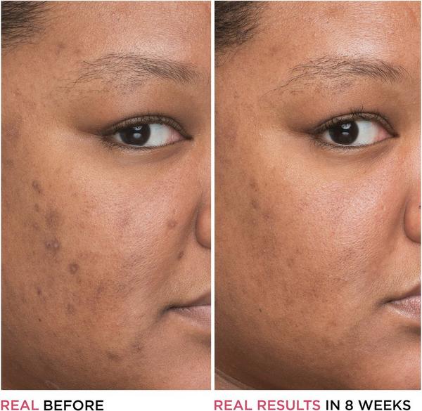 Ulta IT Cosmetics  Bye Bye Dark Spots Niacinamide Serum