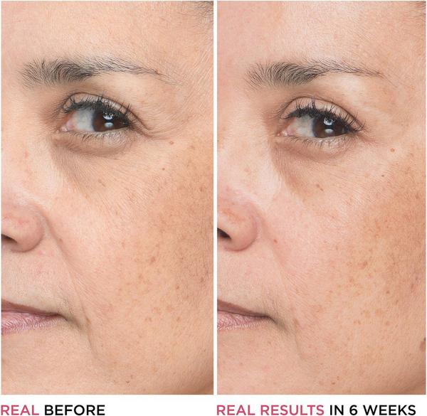 Ulta IT Cosmetics  Bye Bye Lines Hyaluronic Acid Serum