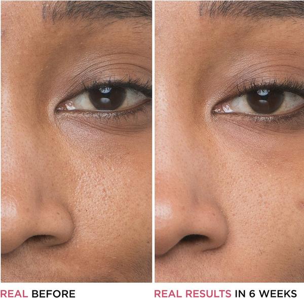 Ulta IT Cosmetics  Bye Bye Pores Glycolic Acid Serum