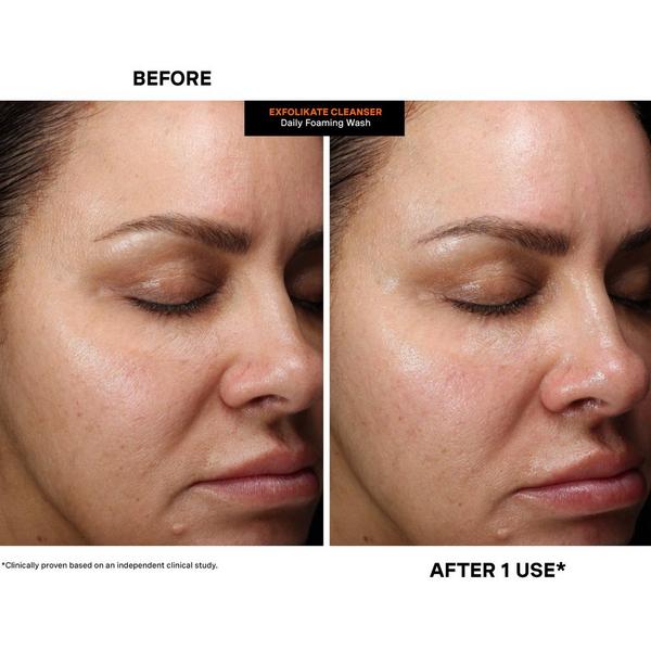 Ulta Kate Somerville  ExfoliKate Cleanser Daily Foaming Wash