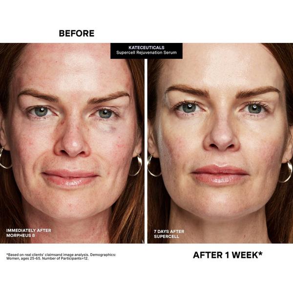 Ulta Kate Somerville  KateCeuticals SuperCell Rejuvenation Serum