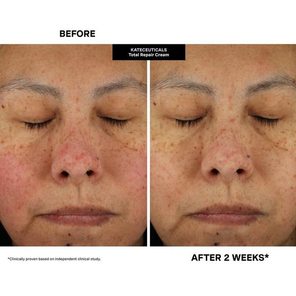 Ulta Kate Somerville  KateCeuticals Total Repair Cream