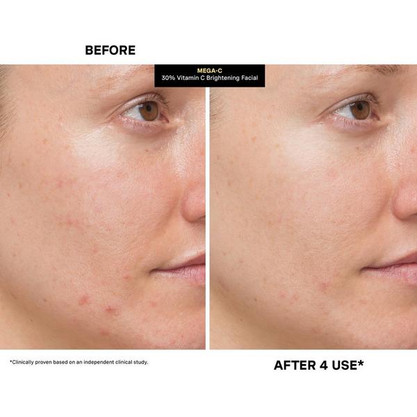 Ulta Kate Somerville  Mega-C 30% Vitamin C Brightening Facial
