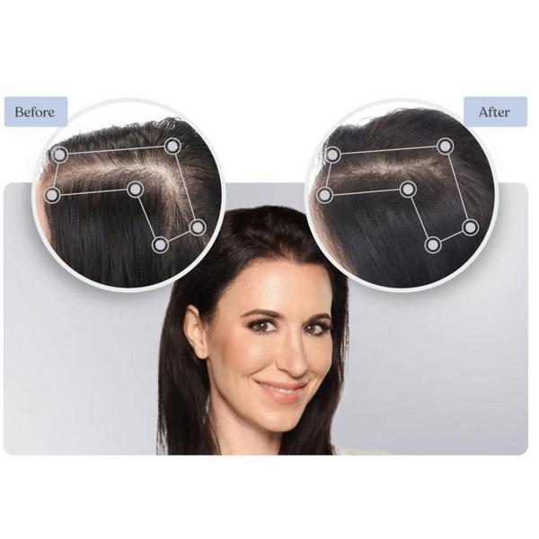 Ulta Keranique  Volumizing Complete Hair Regrowth System