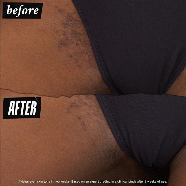 Ulta Kiehl's Since 1851  Ingrown Hair And Tone-Correcting Intimate Drops