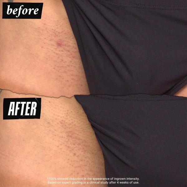 Ulta Kiehl's Since 1851  Ingrown Hair And Tone-Correcting Intimate Drops