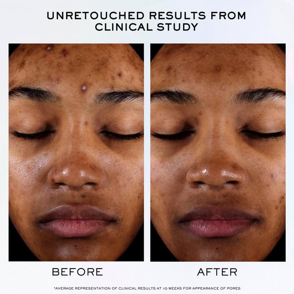 Ulta Lancôme  Clarifique Pro-Solution Brightening & Dark Spot Reducing Serum