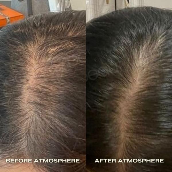 Ulta Luna Nectar  Atmosphere Multi-Peptide Hair Density & Scalp Serum