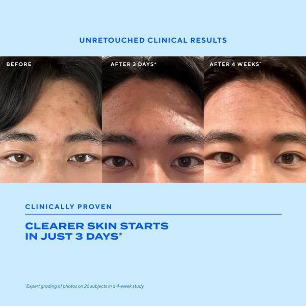 Ulta Murad  Biome-Balancing Clear & Prevent Acne Treatment Serum