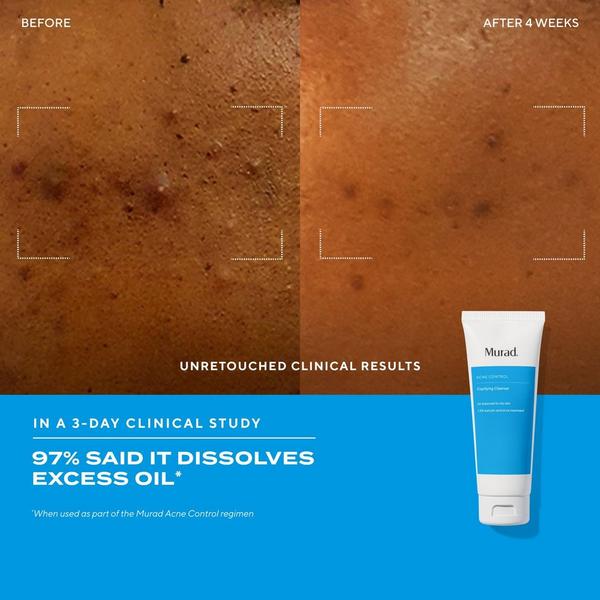 Ulta Murad  Clarifying Gel Cleanser With Salicylic Acid