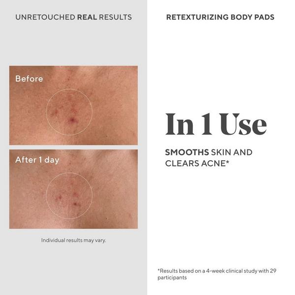 Ulta Murad  Retexturizing Body Pads With Salicylic Acid