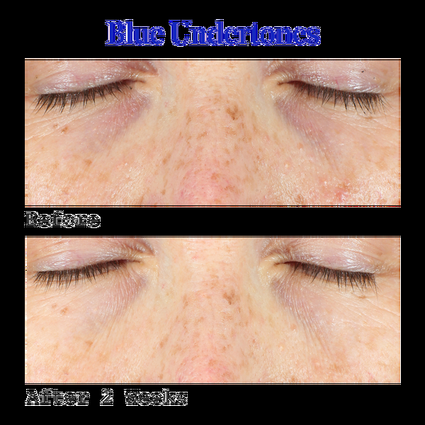 Ulta Murad  Vitamin C Dark Circle Correcting Eye Serum