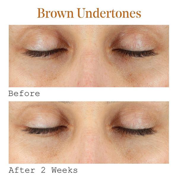 Ulta Murad  Vitamin C Dark Circle Correcting Eye Serum