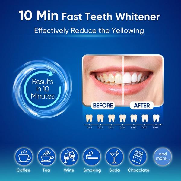 Ulta MySmile  Advanced Teeth Whitening Kit With 28 LED Light