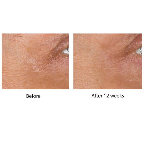 Ulta No7  Laboratories Line Correcting Booster Serum