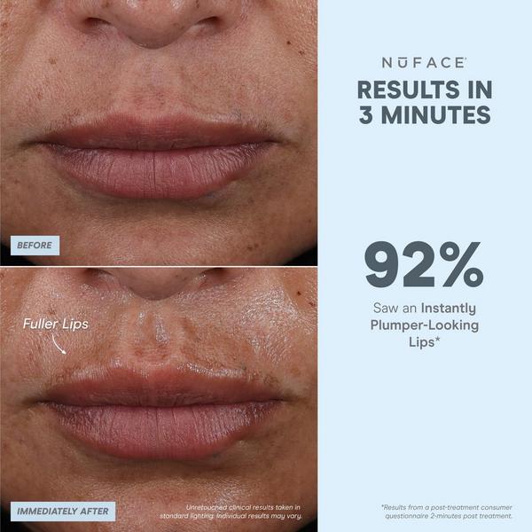 Ulta NuFACE  FIX MicroWand - Targeted Microcurrent Device For Eyes Lips & Lines