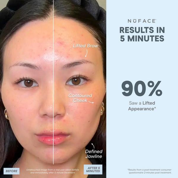 Ulta NuFACE  MINI+ Smart Petite Microcurrent Starter Kit