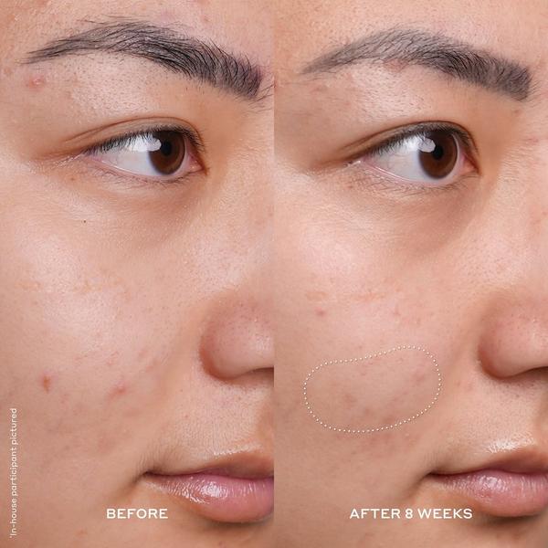 Ulta OLEHENRIKSEN  Banana Bright 15% Vitamin C Dark Spot Serum