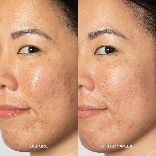 Ulta OLEHENRIKSEN  Glow2OH 7% AHA Exfoliating Dark Spot Toner