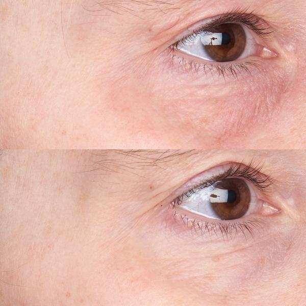 Ulta Perricone MD  Cold Plasma Plus+ Daily Defense Moisturizer Broad Spectrum SPF 35