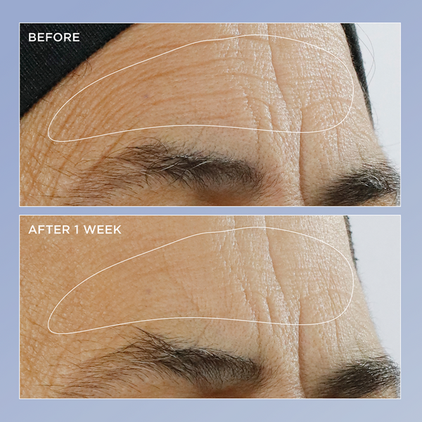 Ulta Perricone MD  High Potency Triple Retinol Renewal Serum