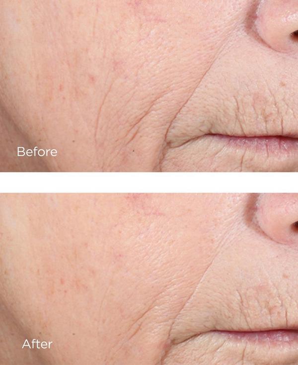 Ulta Perricone MD  Vitamin C Ester CCC+ Ferulic Brightening Complex 20%