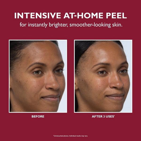 Ulta Peter Thomas Roth  Even Smoother Instant Reveal Facial Peel