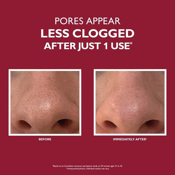 Ulta Peter Thomas Roth  Even Smoother Microdermabrasion Exfoliating Pore Treatment