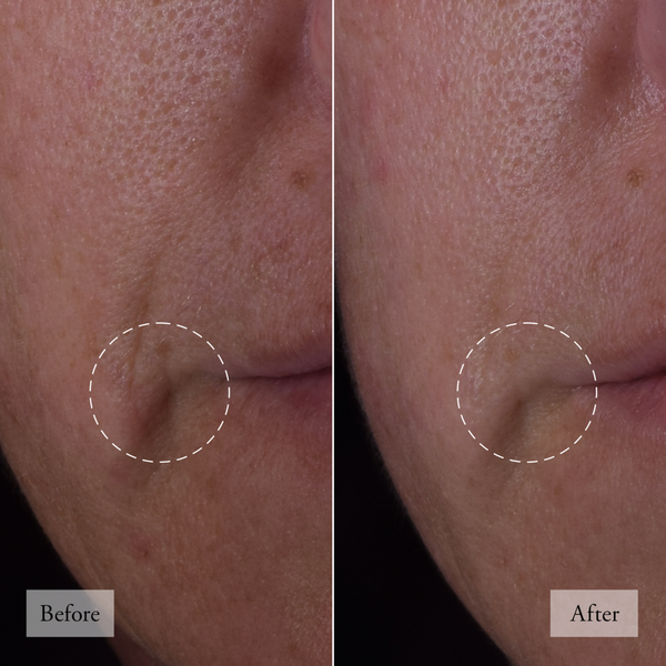 Ulta Philosophy  Dose Of Wisdom Bouncy Skin Reactivating Serum