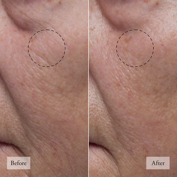 Ulta Philosophy  Hope In A Jar Water Cream Hyaluronic Glow Moisturizer