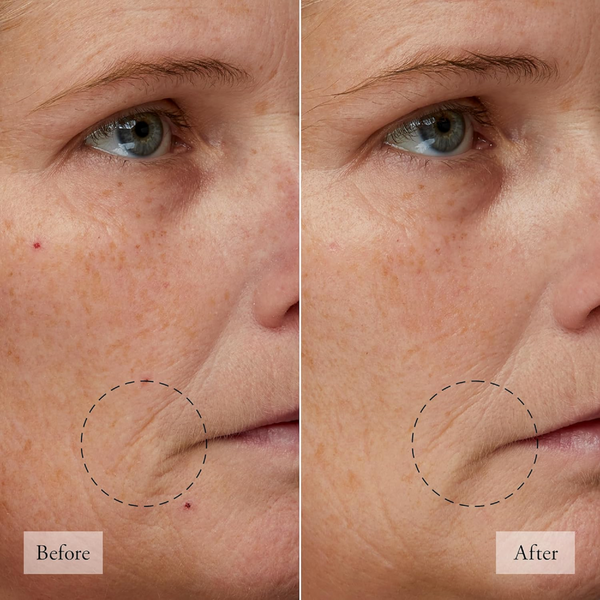 Ulta Philosophy  Microdelivery 2-Step Resurfacing Peel Kit